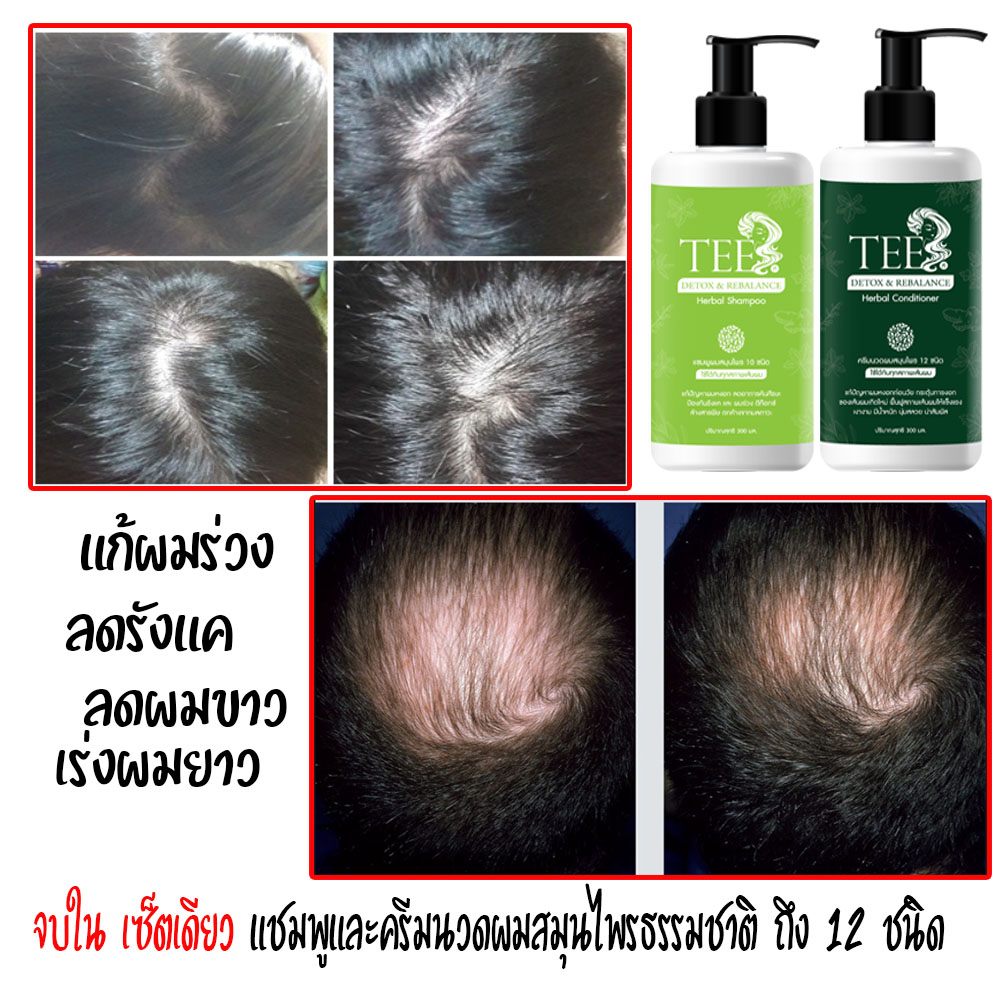 แชมพูครีมนวดผม แก้ผมหงอก ลดผมร่วง เร่งผมยาว ขจัดรังแค ราคาเซ็ตคู่ไม่แพง ถูกมาก สั่งซื้อผ่าน LAZADA SHOPEE ได้เลย