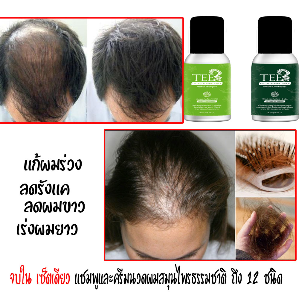 แชมพูครีมนวดผม แก้ผมหงอก ลดผมร่วง เร่งผมยาว ขจัดรังแค ราคาเซ็ตคู่ไม่แพง ถูกมาก สั่งซื้อผ่าน LAZADA SHOPEE ได้เลย