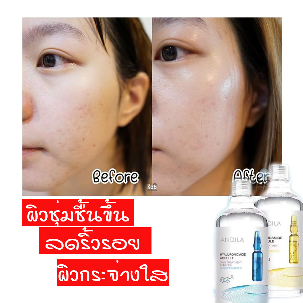 มาส์กหน้า น้ำตบ บำรุงผิว ให้สดชื้น ลดริ้วรอย กระชับรูขุมขน เห็นผลใน 1 ขวดแรก